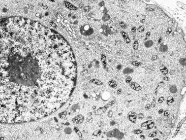 Fig. 12.21, Leydig cells have eccentric, round nuclei, abundant smooth endoplasmic reticulum and mitochondria, lysosomes, and stacks of rough endoplasmic reticulum cisternae.