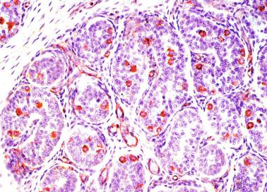 Fig. 12.22, Testis from a 4-day-old infant.