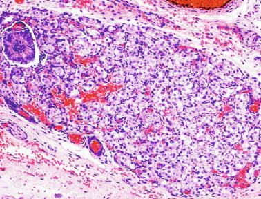 Fig. 12.23, Newborn epididymis showing a paraganglion around the epididymal duct.