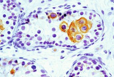 Fig. 12.24, Testis from a 4-year-old infant.