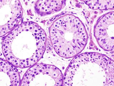 Fig. 12.26, Testis from an 11-year-old boy.