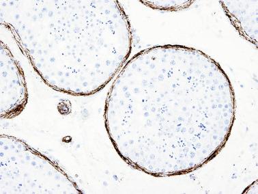 Fig. 12.38, The three to five layers of myofibroblasts surrounding seminiferous tubules show intense immunostaining for muscle-specific actin.