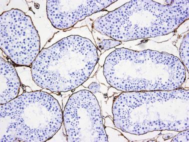 Fig. 12.39, A network of CD34+ stromal cells forms the frame of testicular interstitium surrounding seminiferous tubules, Leydig cell groups, and blood vessels.