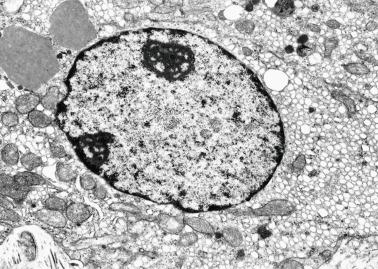 Fig. 12.40, Leydig cells with round nuclei, abundant smooth endoplasmic reticulum, mitochondria with tubular cristae, and Reinke crystalloids.