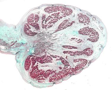 Fig. 12.43, Cross-sectioned rudimentary testis from a 2-year-old infant. Testicular lobules are separated by wide septa and contain scant seminiferous tubules.