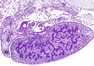 Fig. 12.5, Longitudinal section of an 8-week-old fetal testis showing sex cord configuration. In the hilum, there are several glomeruli and nephric tubules.