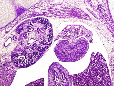 Fig. 12.9, Transverse section of a fetus showing the relationship of the testis to abdominal organs such as liver, kidney, and digestive tract.