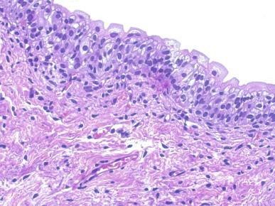 Fig. 5.3, Umbrella cells have voluminous cytoplasm and large nuclei with inconspicuous nucleoli.