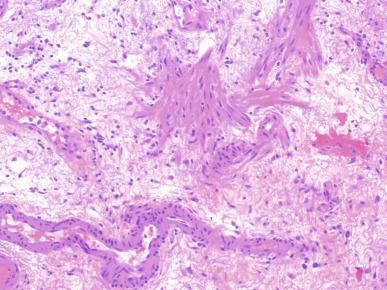 Fig. 5.5, Smooth muscle in lamina propria is arranged in small irregular bundles.