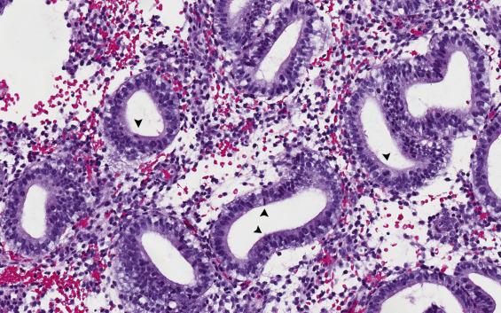 FIG. 9.3, Day 16 (periovulatory) endometrium. Variable subnuclear epithelial vacuolization is observed, usually discontinuous and patchy. In addition, mitotic figures are readily identified (arrowheads).