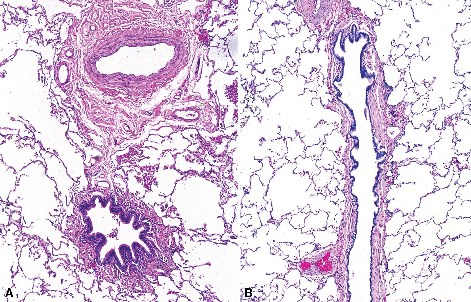 Figure 9.12, Terminal bronchiole. (A) A cross section of a terminal bronchiole and adjacent artery. The normal terminal bronchiole has a thin wall and an open lumen. The wall is composed of a variably enfolded mucosa, showing a columnar to cuboidal epithelium with ciliated columnar cells and Clara cells. The folding of the epithelium and basement membrane is thought to be due to ex vivo smooth muscle contraction of the bronchiolar wall. (B) This bronchiole is cut lengthwise; its major axis is relatively straight, and the lumen has a relatively constant diameter.