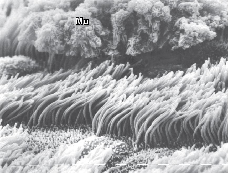 • Fig. 11.1, Scanning electron micrograph of ciliated epithelial cells beneath the mucous (Mu) lining the larger airways.