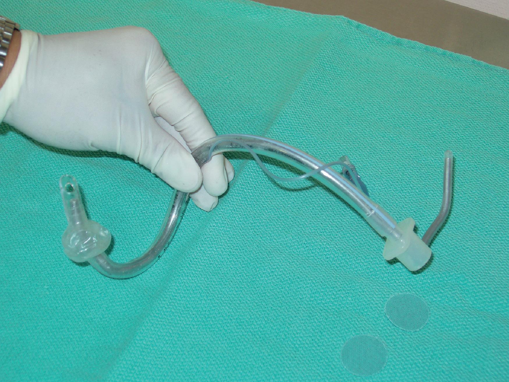 Fig. 21.2, The proximal half of the ETT is bent 90 degrees toward the dominant side of the clinician.