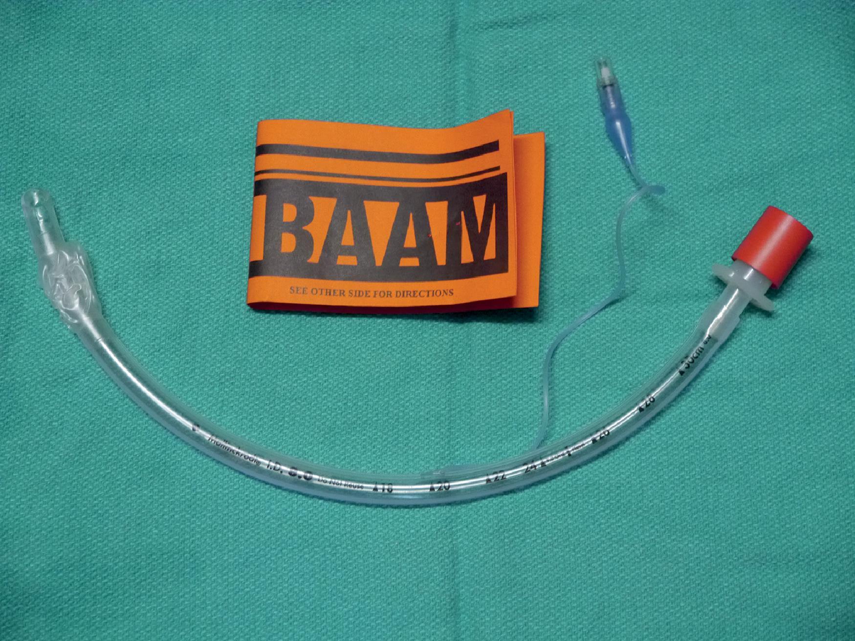 Fig. 21.9, The BAAM placed at the connector of the ETT.