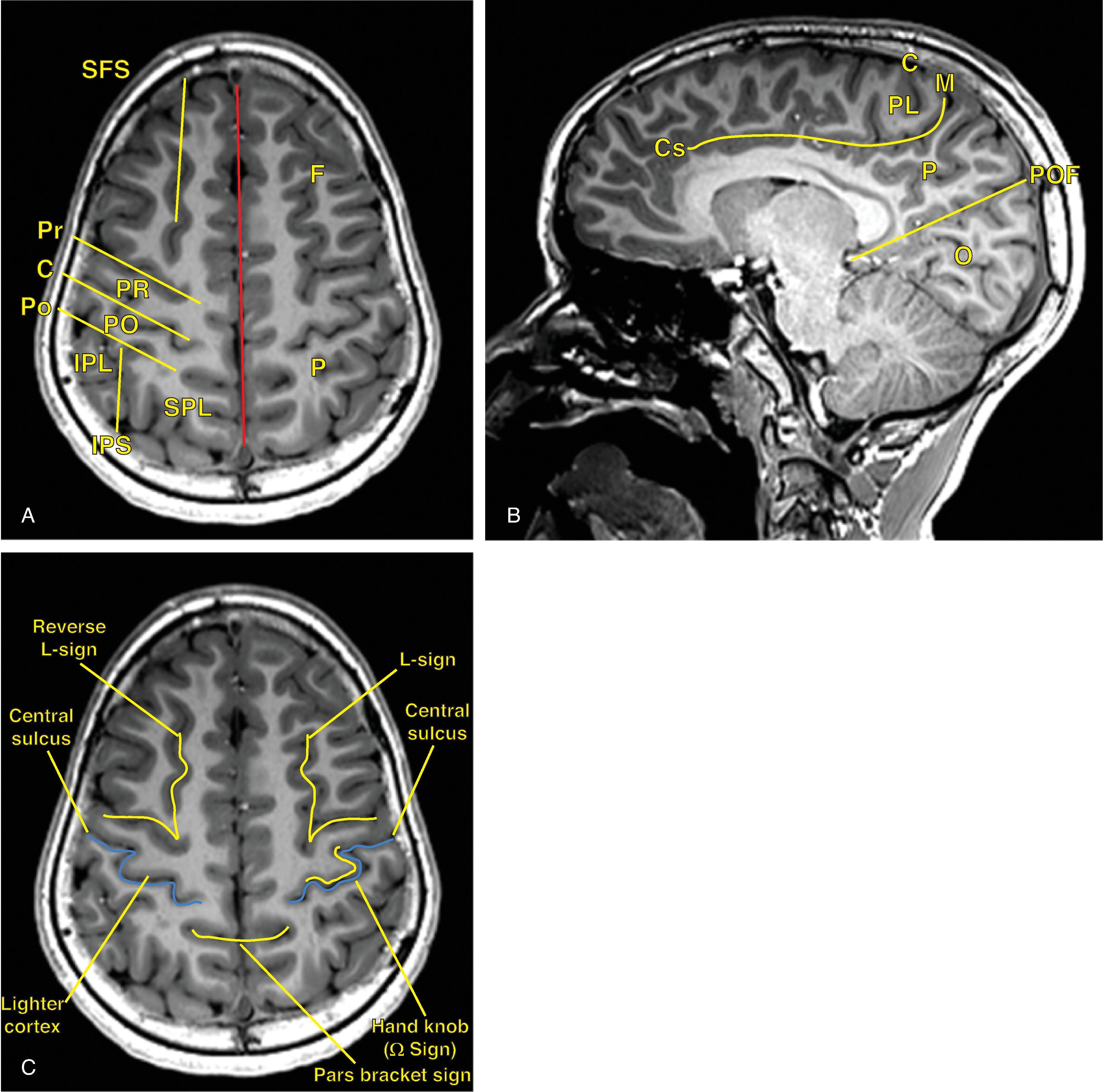 Fig. 21.2, Central Sulcus.