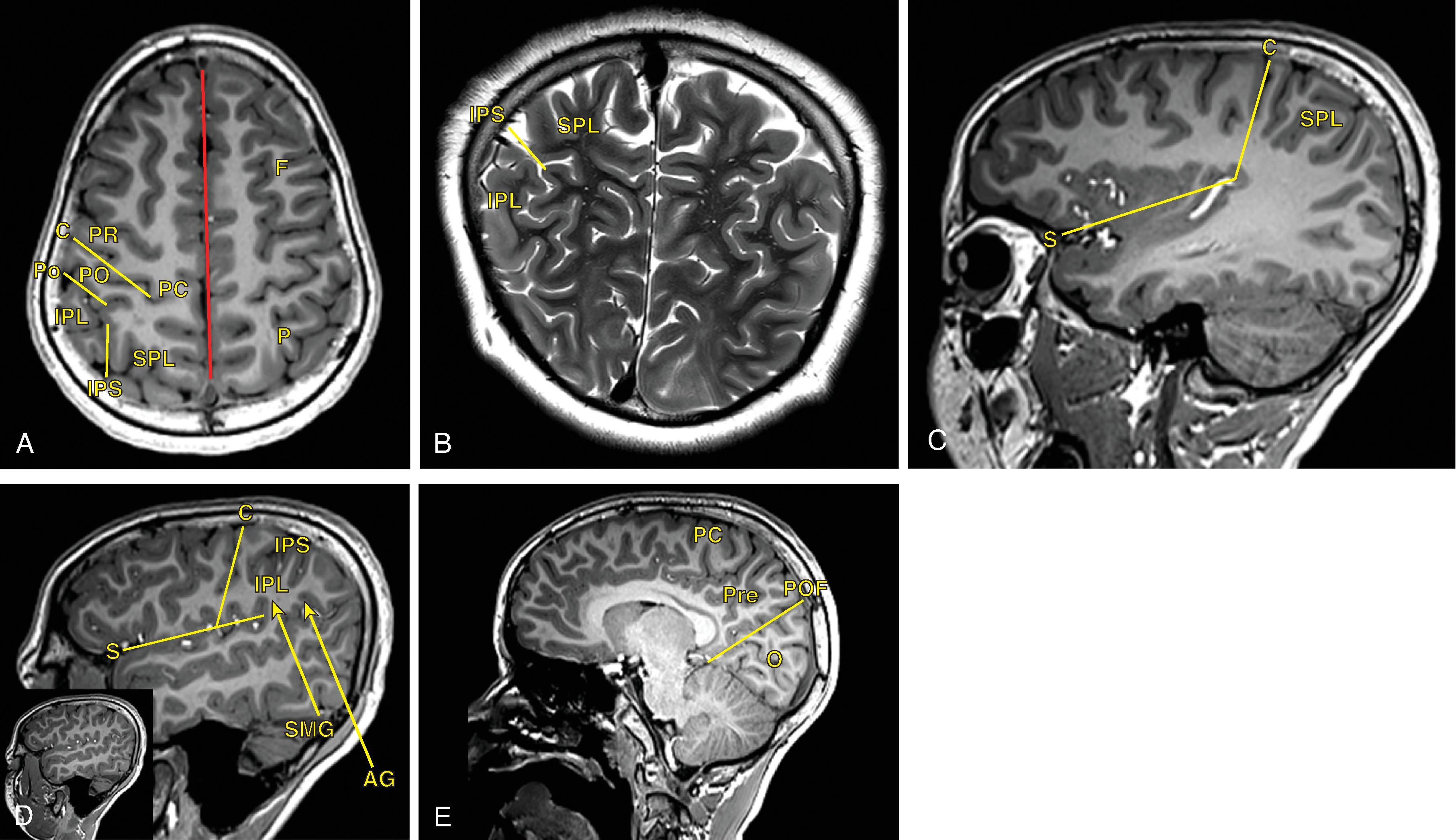 Fig. 21.4, Parietal Lobe Anatomy.