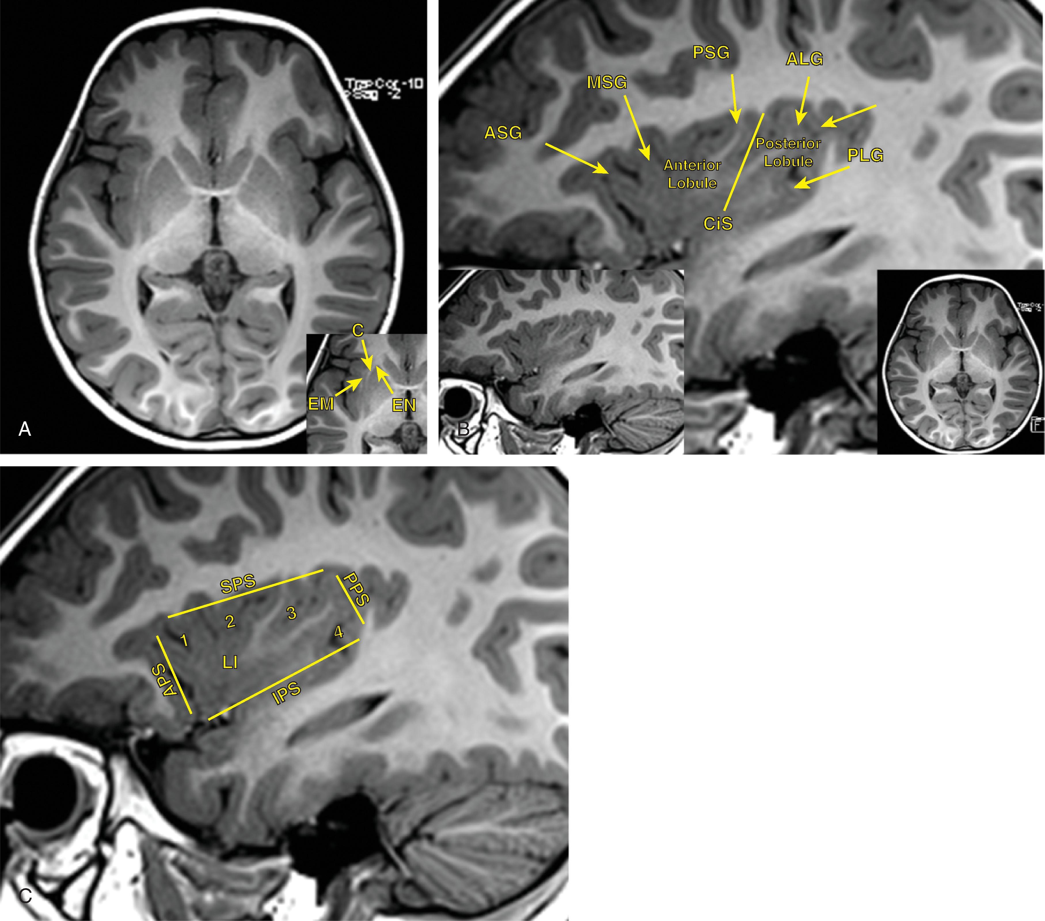 Fig. 21.5, Insula Anatomy.