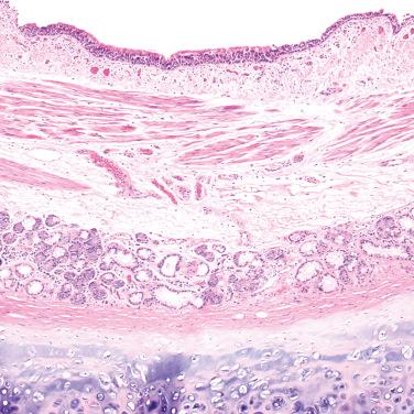 FIG. 1.1, Bronchus. The bronchial wall features pseudostratified ciliated columnar epithelium with goblet cells, submucosal seromucinous glands, bronchial vessels and lymphatics, smooth muscle, and hyaline cartilage.