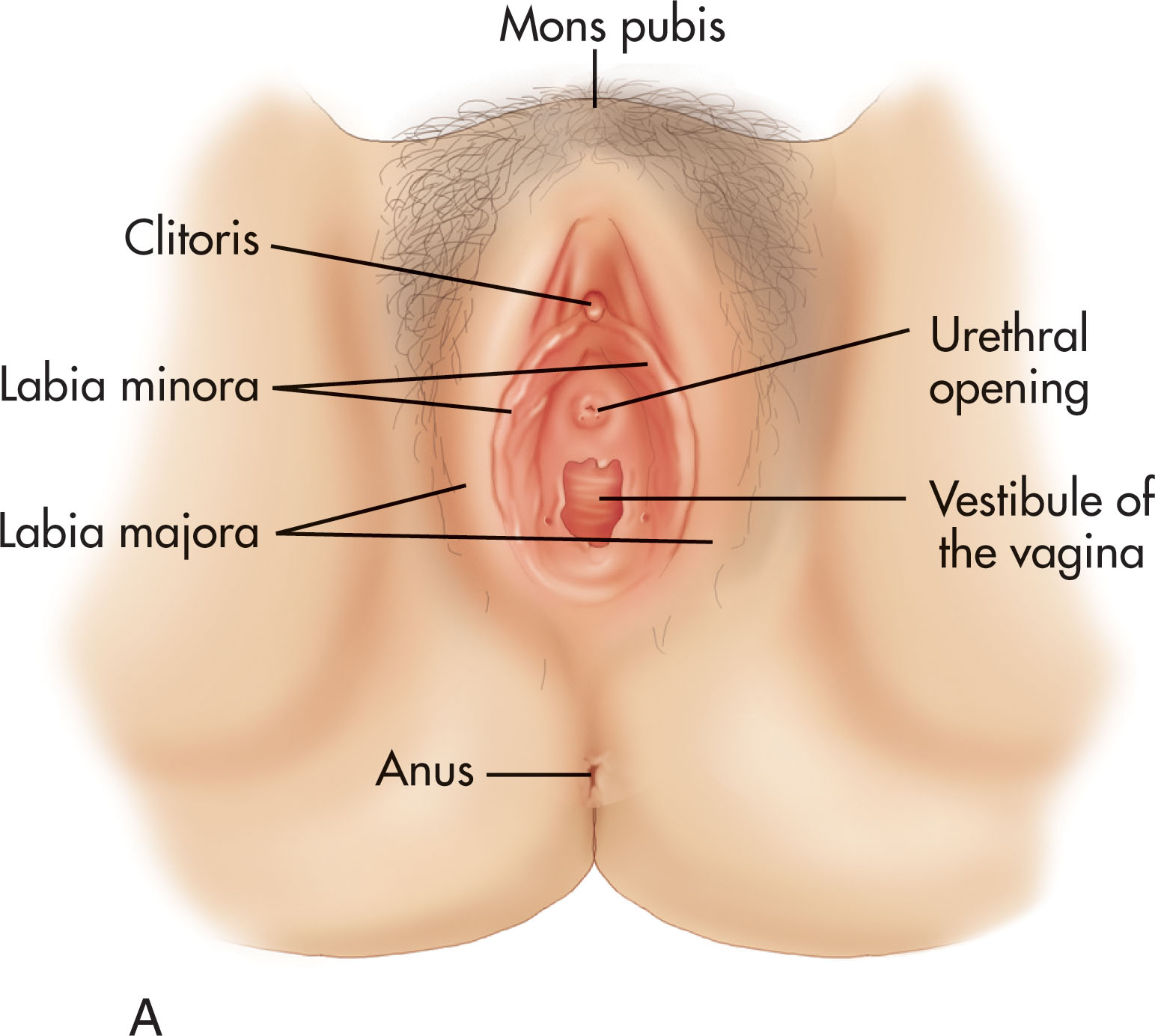 Fig. 41.2, (A) The external genitalia in the female, also known as the vulva or the pudendum , consist of the mons pubis, labia majora, labia minora, clitoris, urethral opening, and vestibule of the vagina. (B) Anatomically, the pelvis is divided into two continuous compartments (true and false pelvis) by an oblique plane that passes through the pelvic brim. (C) This plane of division passes from the superior border of the sacrum to the superior margin of the pubic symphysis and corresponds to the iliopectineal line.