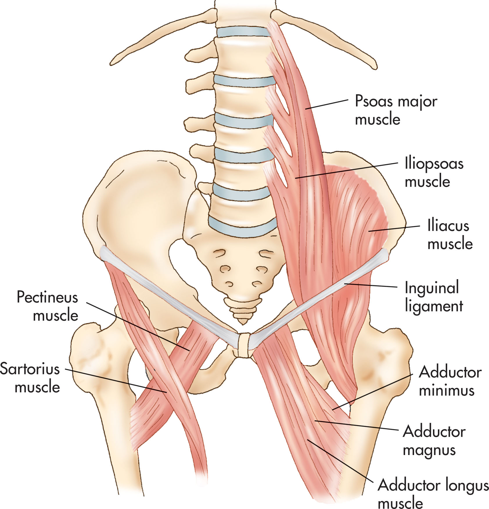 Fig. 41.4, Anterior diagram of the psoas major muscle extending from the abdominal cavity into the false pelvis. The iliacus muscle joins the psoas muscle to form the iliopsoas muscle along the sidewall of the false pelvis.