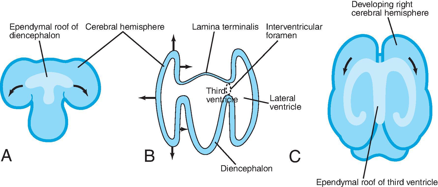 Ventricle Embryology. (A) Sketch of the dorsal surface of the forebrain. Arrows indicate how the ependymal roof of the diencephalon is carried out to the dorsomedial surface of the cerebral hemispheres. (B) Diagrammatic section of the forebrain showing how the developing cerebral hemispheres grow from the lateral walls of the forebrain and expand in all directions until they cover the diencephalon. The rostral wall of the forebrain, the lamina terminalis, is very thin. (C) Sketch of the forebrain showing how the ependymal roof is finally carried into the temporal lobes as a result of the C-shaped growth pattern of the cerebral hemispheres carry the ependymal roof into the temporal lobes. The arrows indicate some of the directions in which the hemispheres expand. (From Moore, Keith L, TVN Persaud, Torchia MG. Before We Are Born: Essentials of Embryology and Birth Defects . 10th ed. Elsevier; 2020.)