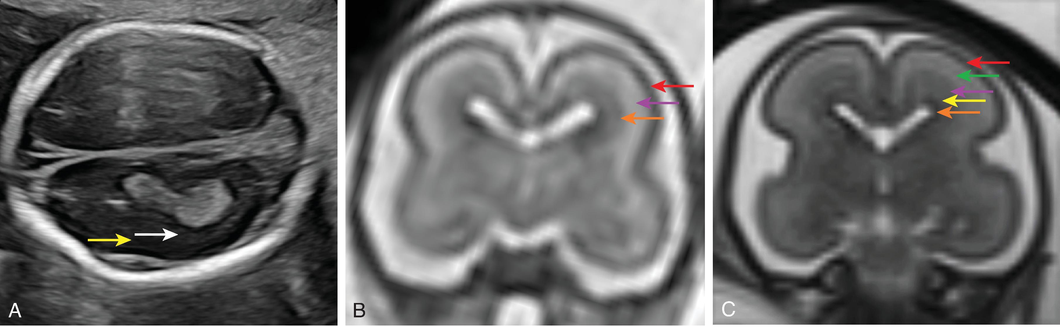 Fig. 1.3, Normal Fetal Parenchyma .