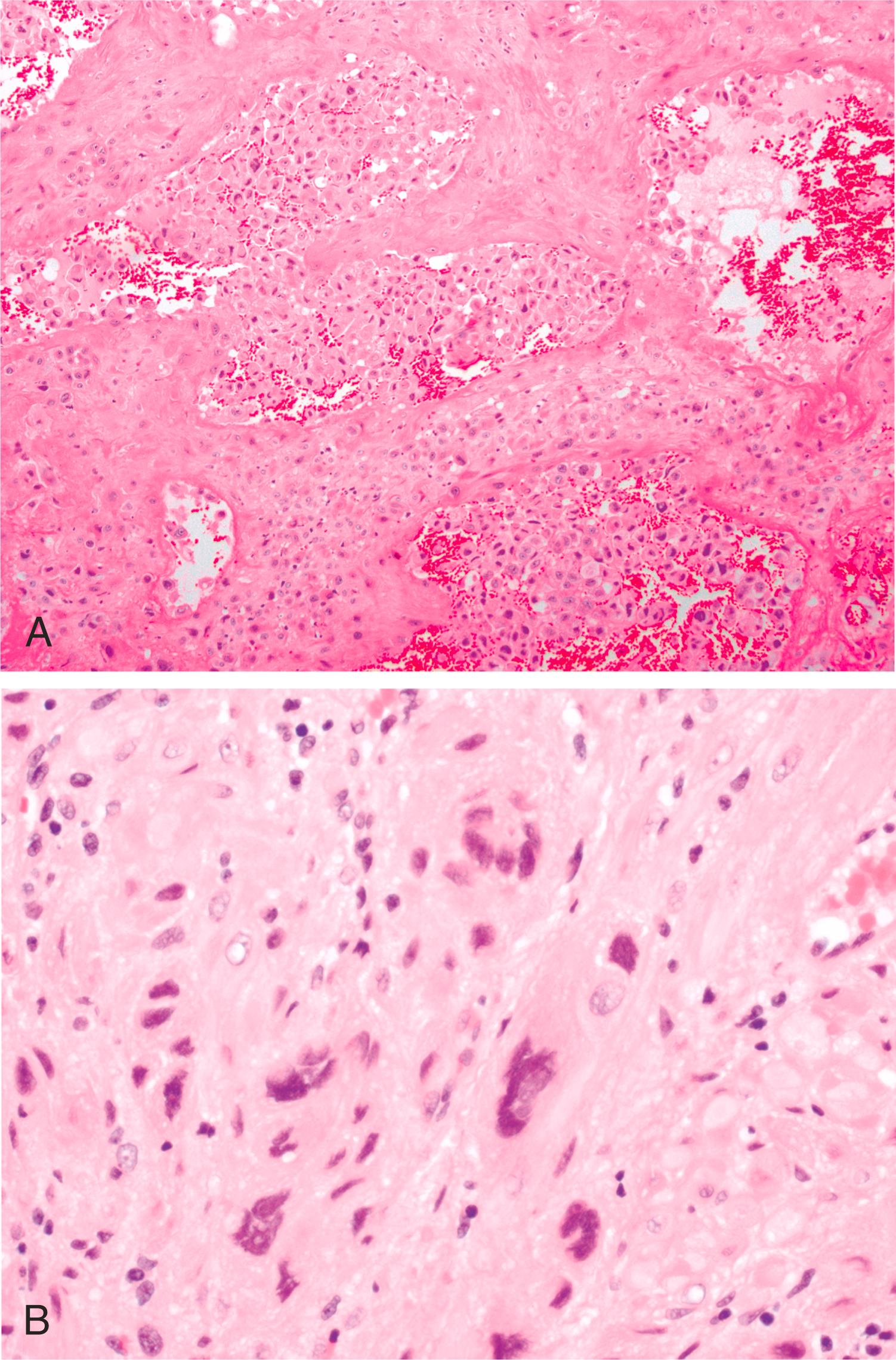 Figure 3.6, Hematoxylin and eosin–stained images of placental implantation site.