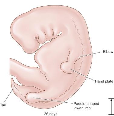 Fig. 11.2, The 36-day embryo: paddle-shaped limb (length, 9 mm).