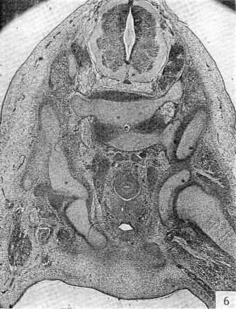 Fig. 11.7, Human hip at the end of embryonic development. Note that the femoral head is completely distinct from the acetabulum. This is the first time the joint could conceivably dislocate.