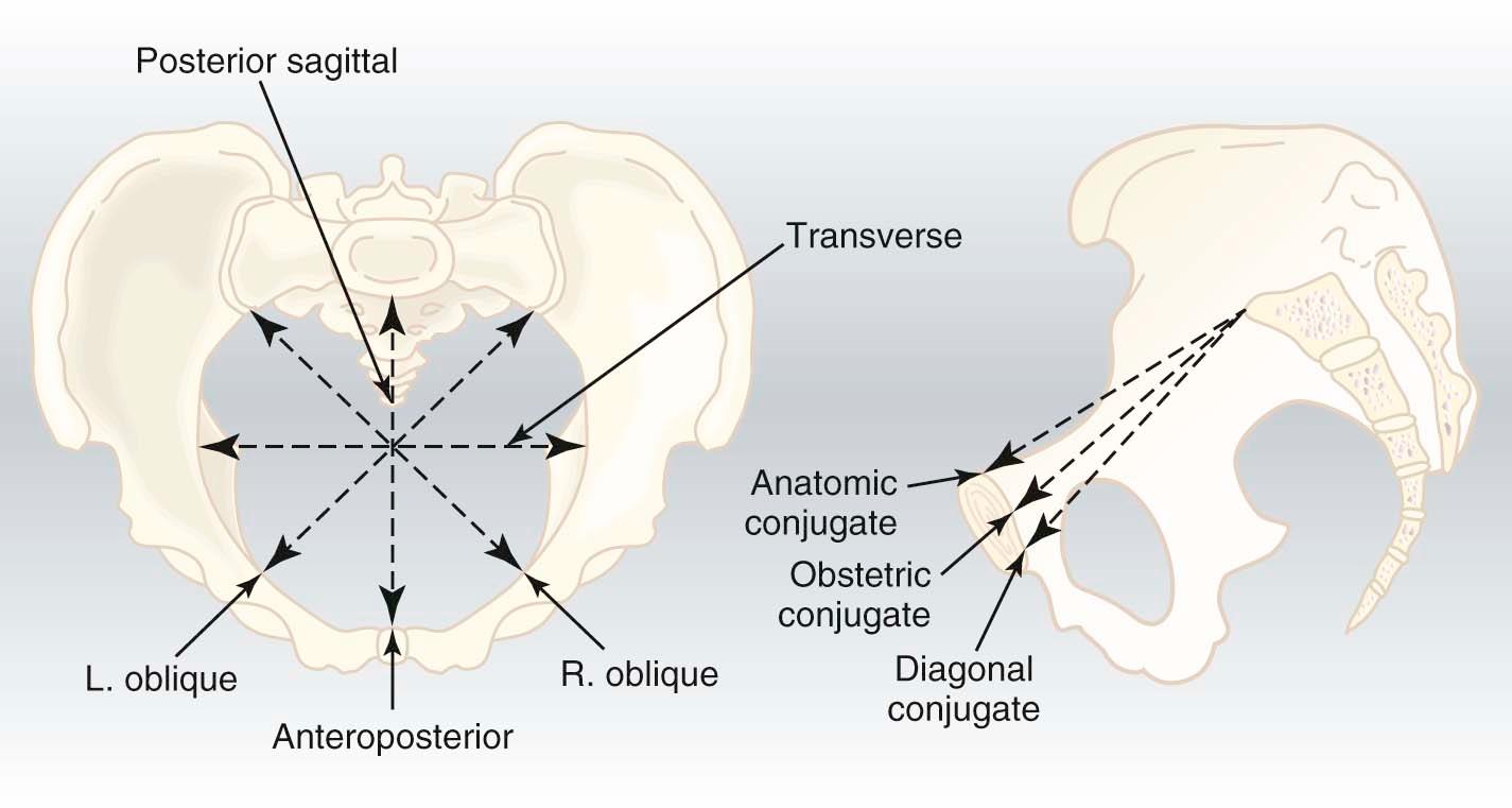 FIGURE 8-3, Pelvic inlet and its diameters.