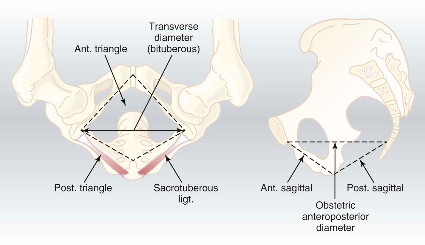 FIGURE 8-4, Pelvic outlet and its diameters.