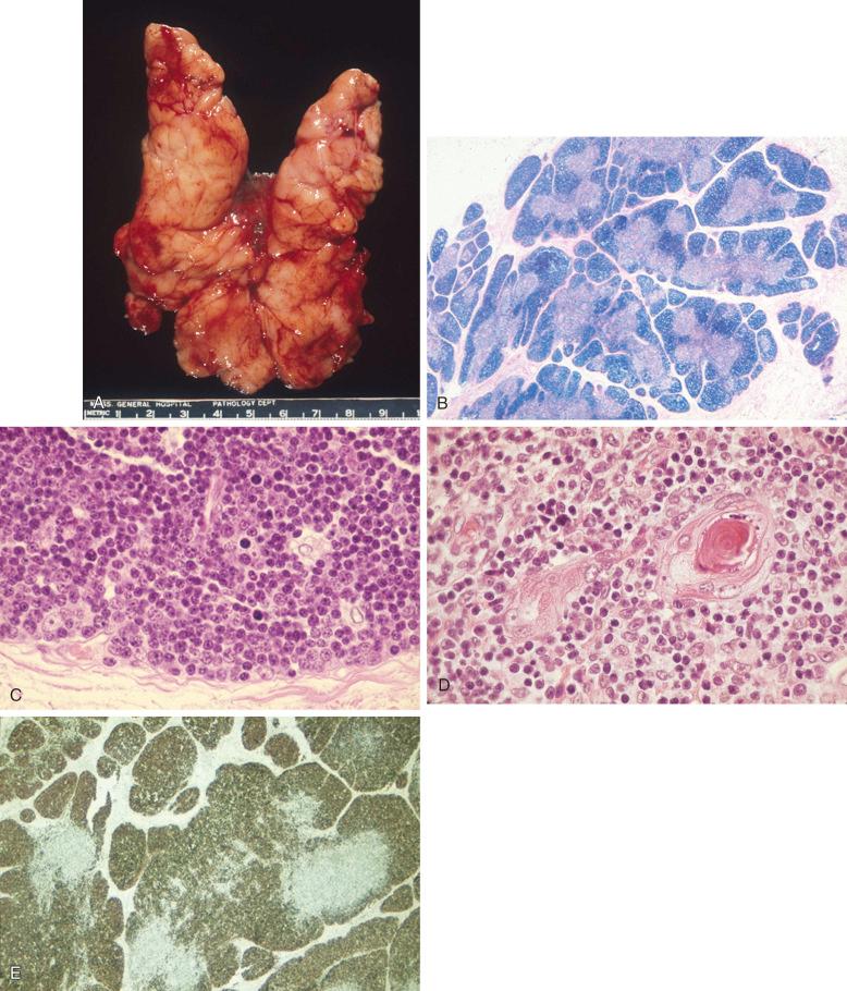 Figure 8-1, Thymus.