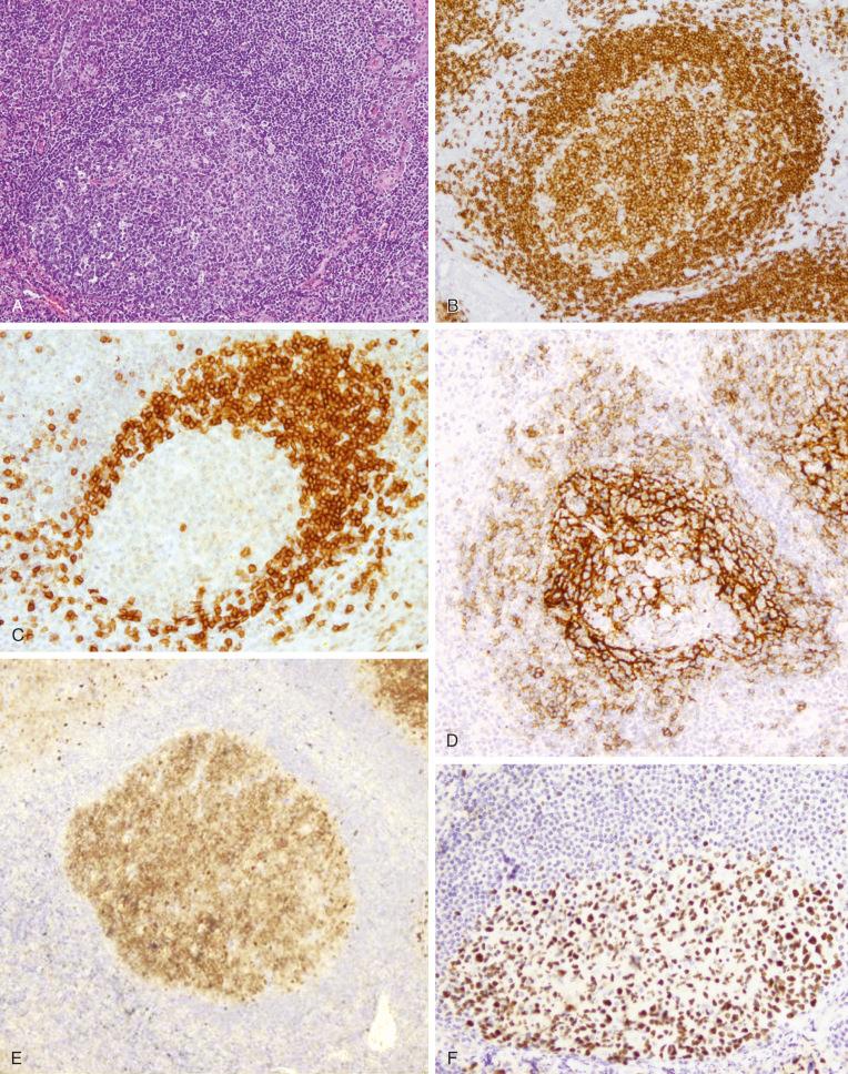 Figure 8-3, Secondary follicle.