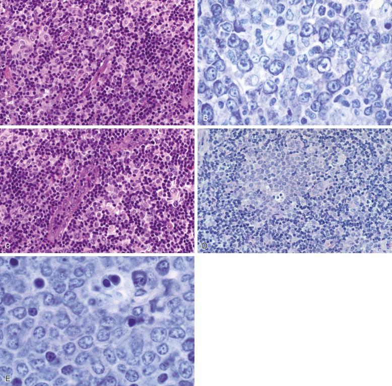 Figure 8-4, Lymph node paracortex.