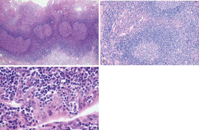 Figure 8-6, Mucosa-associated lymphoid tissue (MALT).