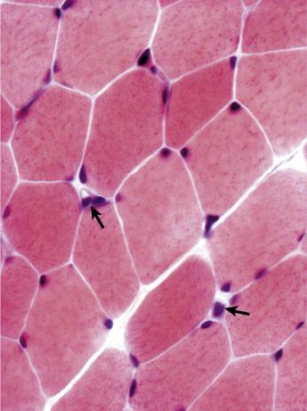 Fig. 3.3, At high power, the intermyofibrillar network is visible and capillaries between the fibres can be distinguished (arrows). Mean fibre diameter approximately 36 μm (H&E).
