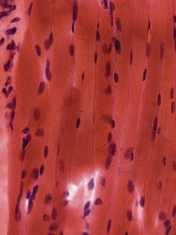 Fig. 3.4, In longitudinal section, nuclei elliptical in shape can be seen at the sarcolemma, some of which are less distinct and relate to the sarcolemma out of the plane of section. Cross-striations are not easily distinguished in unfixed frozen sections but are apparent in some fibres. Quadriceps muscle biopsy from a 4-month-old child, mean fibre diameter approximately 15 μm (H&E).