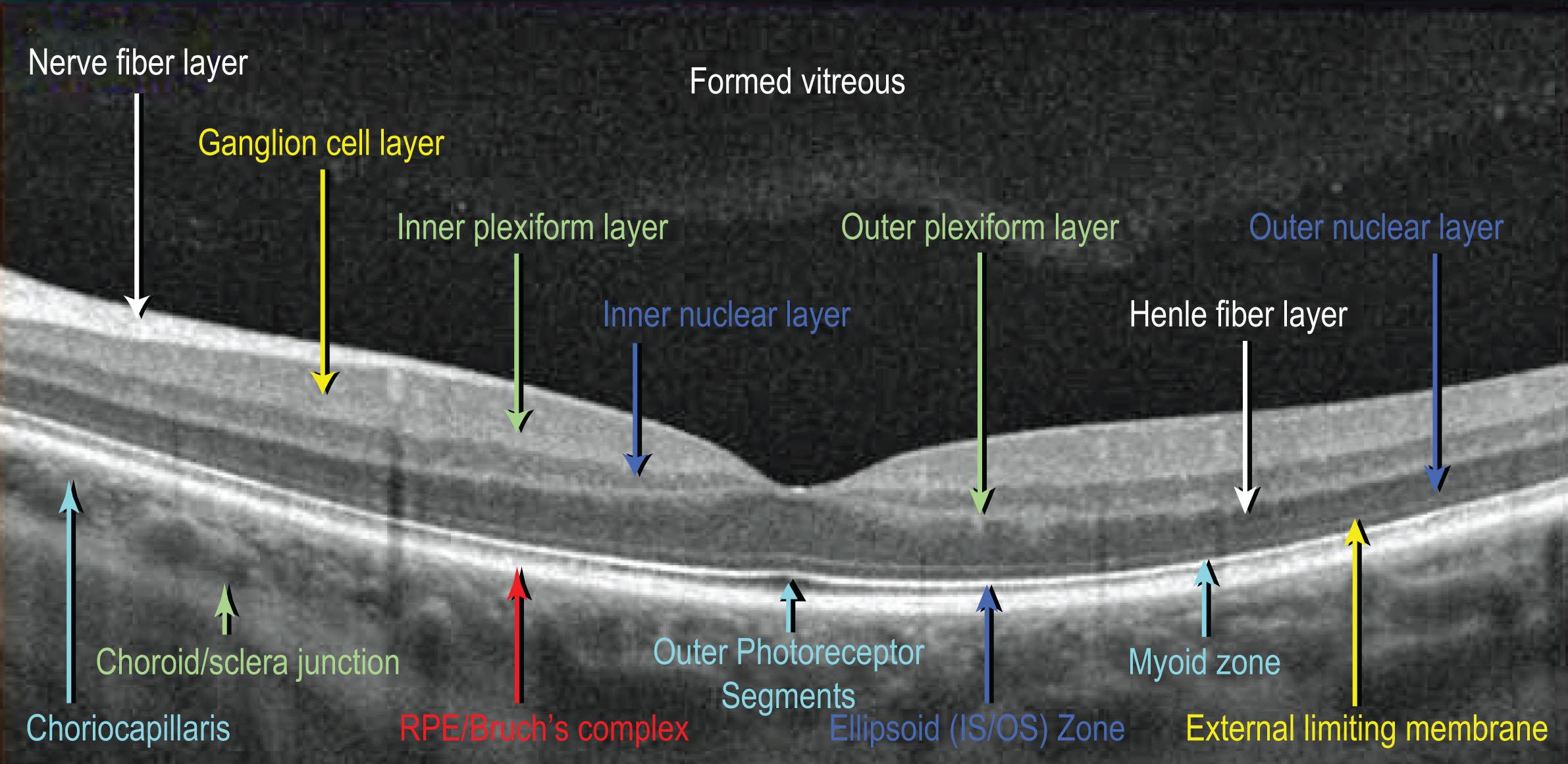 Figure 4.1.1, Normal retinal anatomy.