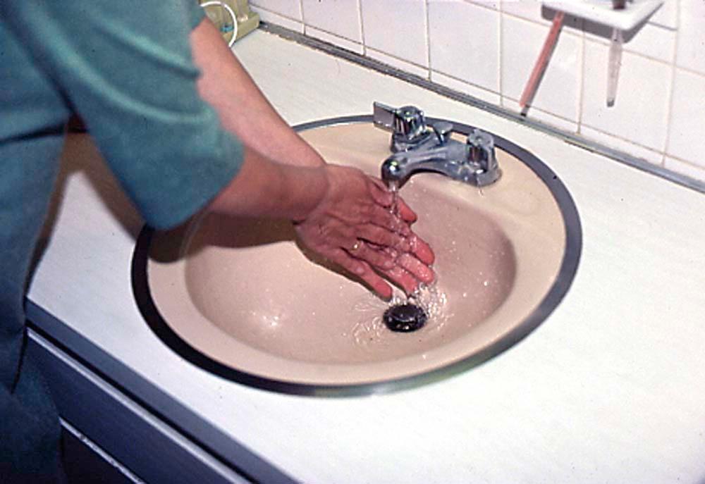 Figure 33-1, Obsessive-compulsive disorder patient demonstrating a typical compulsive behavior of handwashing. Some patients may wash their hands hundreds of times daily, leading to inflamed, erythematous, and cracking skin.