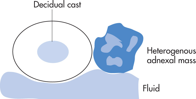 FIG. 10.13