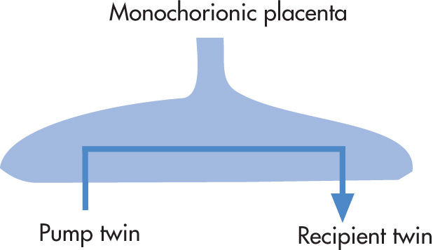 FIG. 10.16