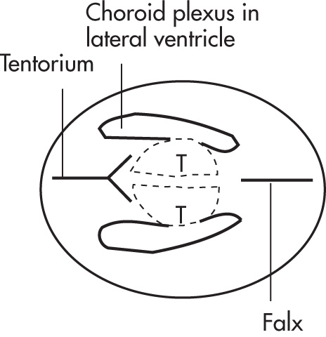 FIG. 10.18