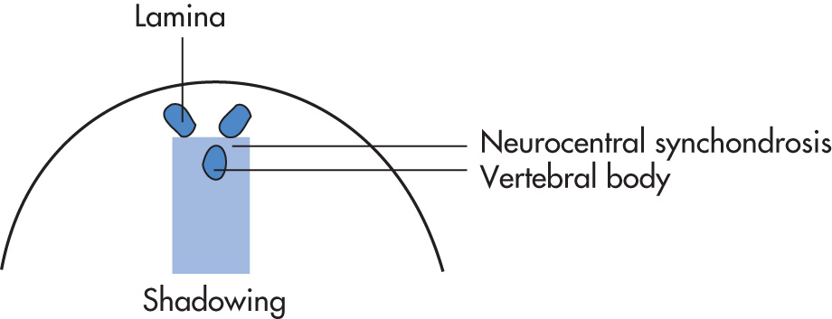 FIG. 10.19