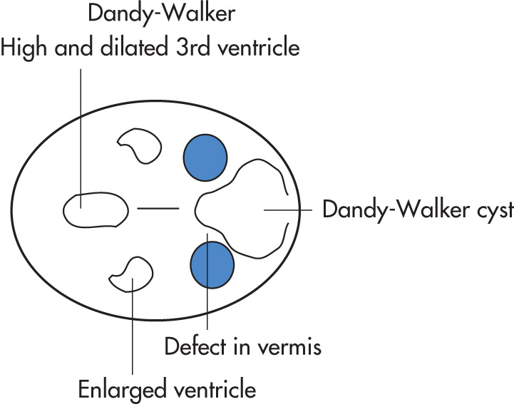 FIG. 10.22