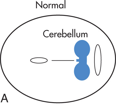 FIG. 10.23