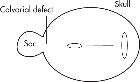 FIG. 10.25