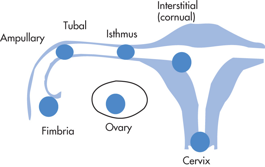 FIG. 10.10