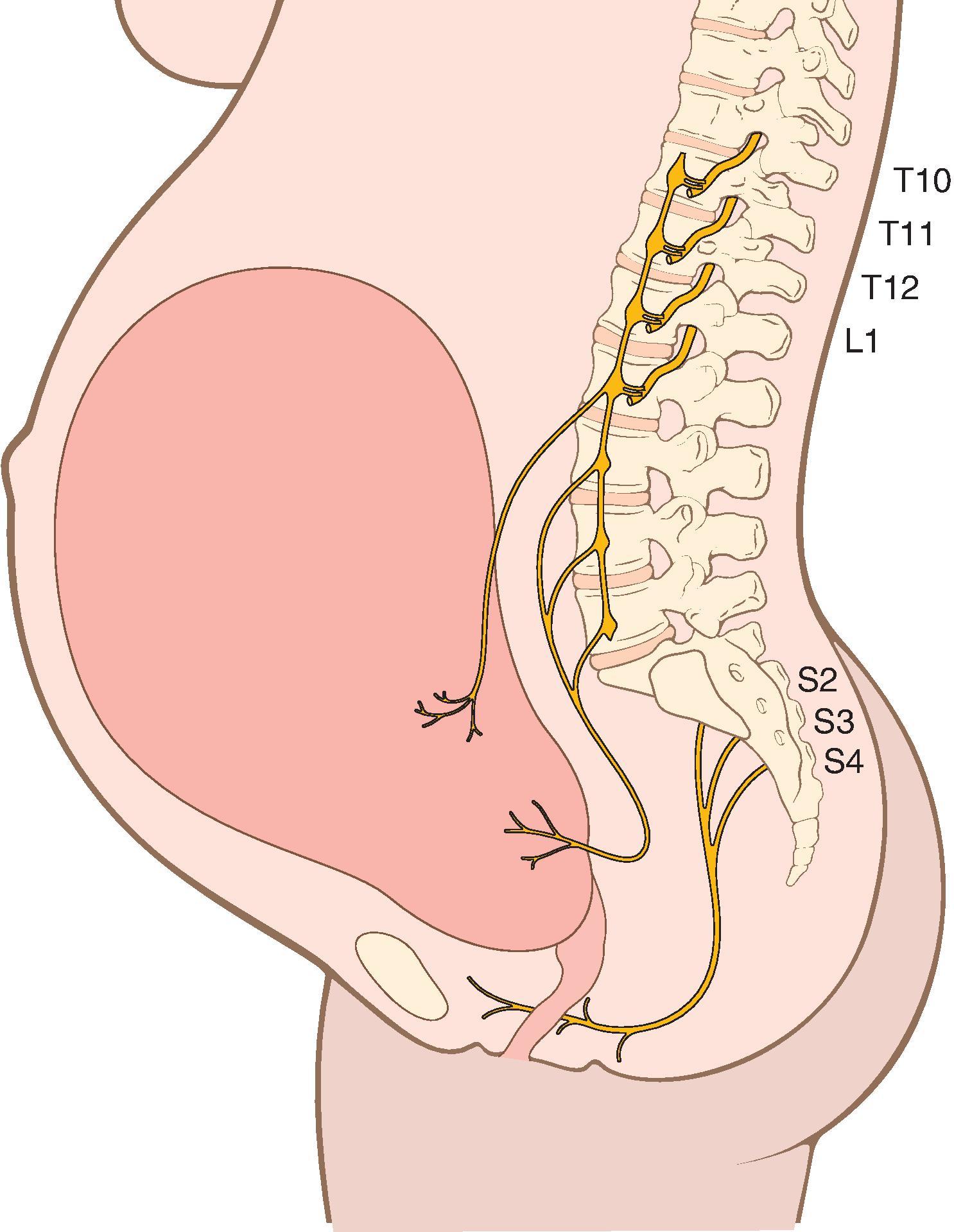 Fig. 33.3, Schematic Diagram of Pain Pathways During Pregnancy.