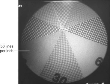 Fig. 75.23, A resolution test pattern with 3 inches of poly(methyl methacrylate) (PMMA) acrylic on the image intensifier of a mini C-arm device. The 50 lines per inch wire mesh pattern is resolved clearly.