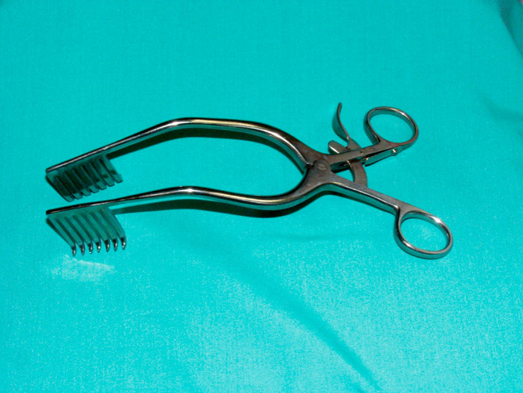 eFigure 61.23, Miskimon retractor.